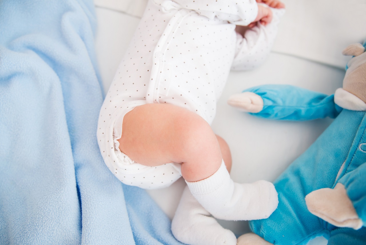 Дисплазия тазобедренного сустава (ДДТБ) - 2