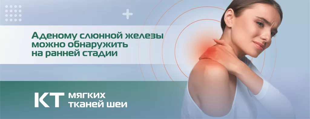 КТ - мягкие ткани и лимфоузлы шеи, слюнные железы.png