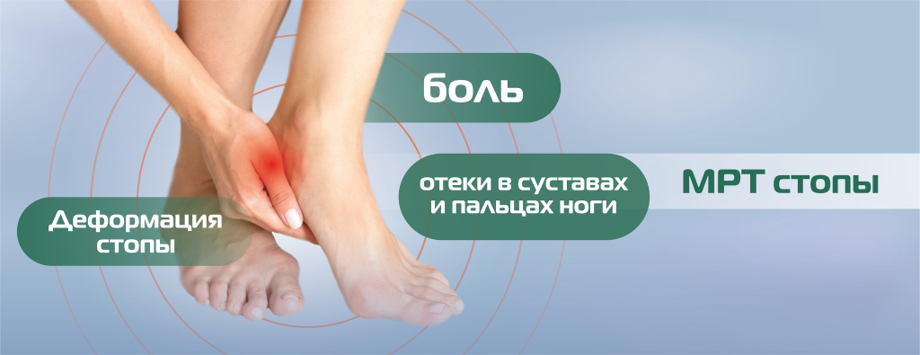 МРТ_нижние конечности, стопа(БЕЗ ЦЕНЫ).png